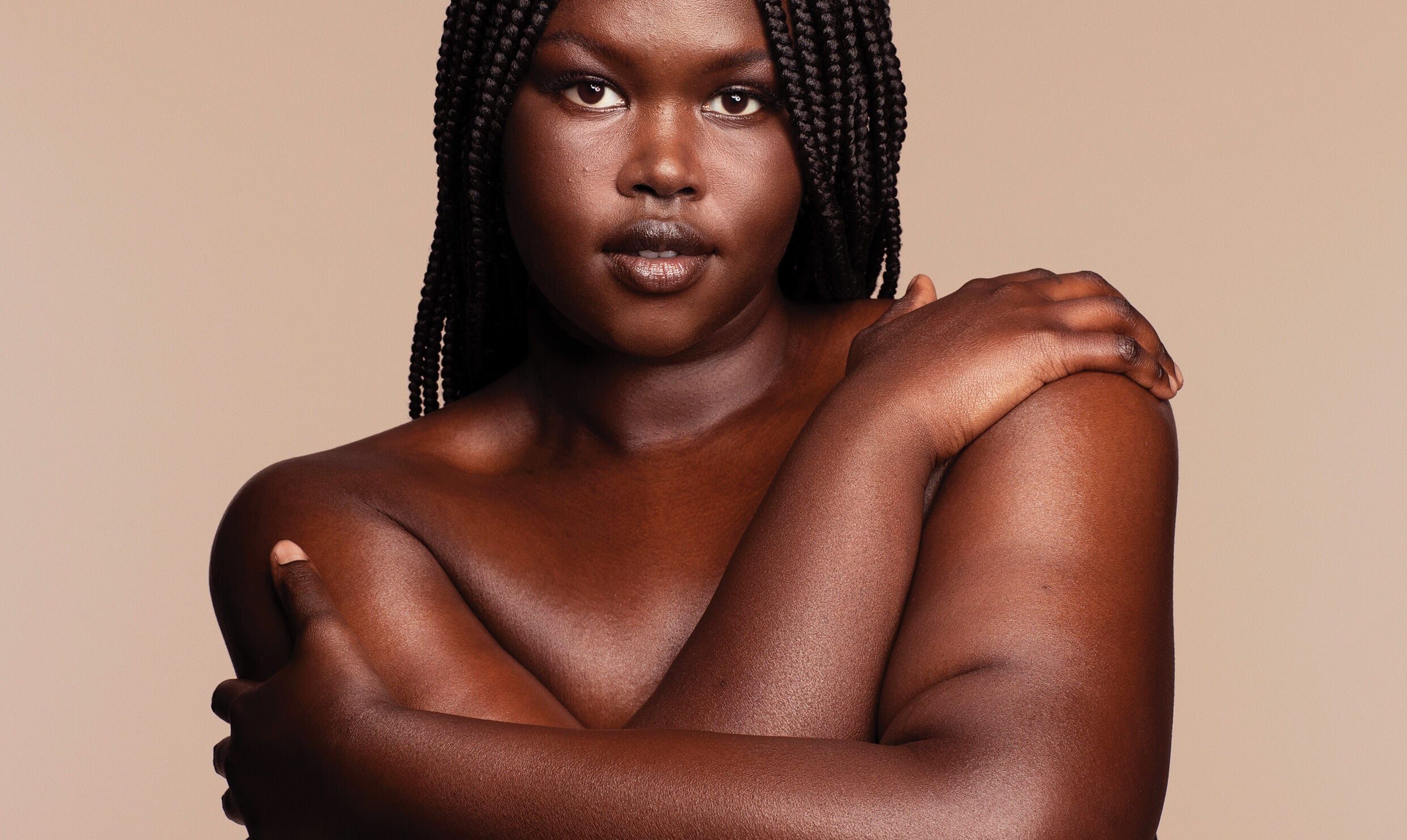 ECZEMA VS DERMATITIS – Kate Somerville US ECZEMA VS DERMATITIS – Kate Somerville US