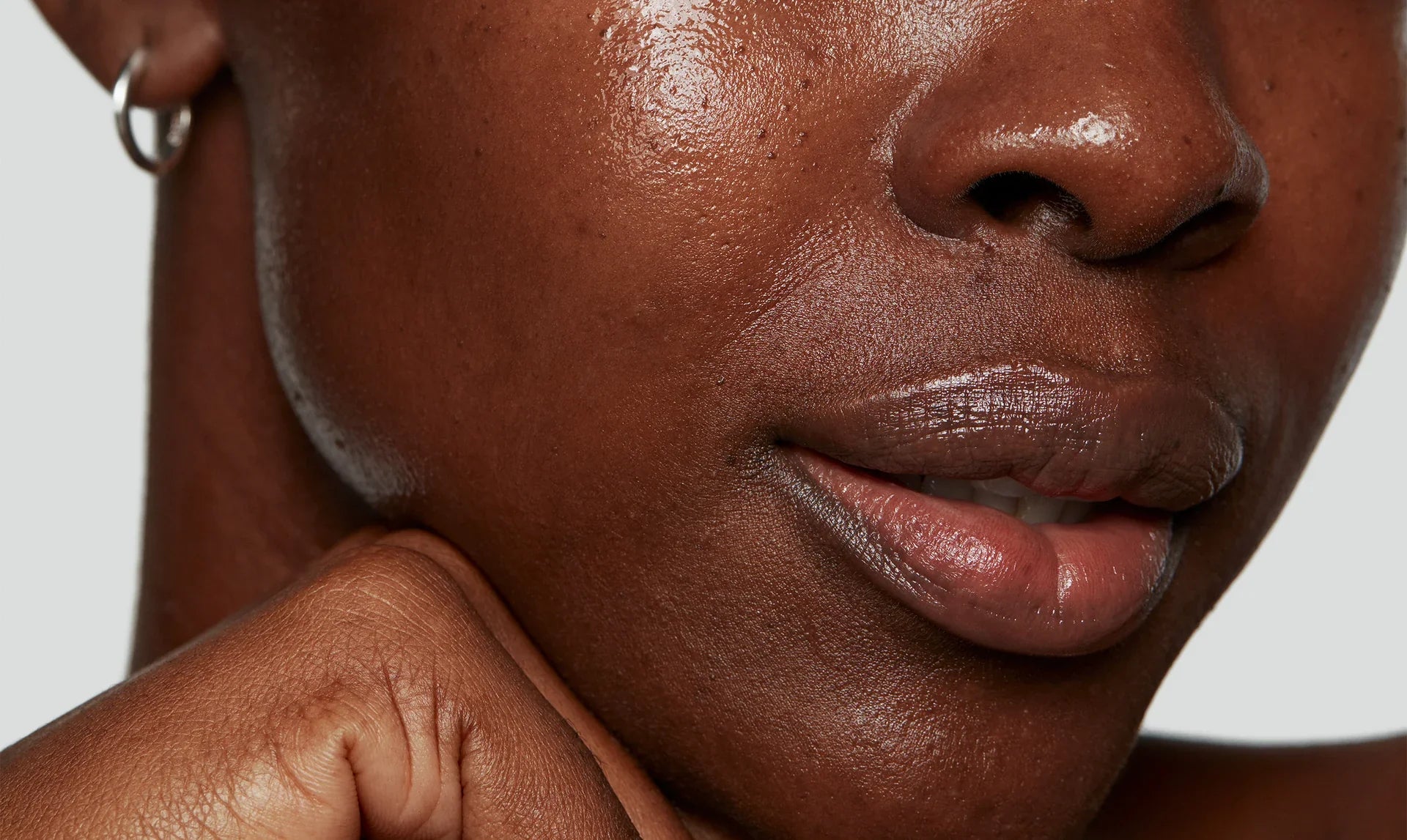 Five Niacinamide Skin Benefits