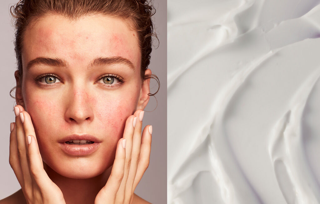 CAUSES OF IRRITATED SKIN ON THE FACE