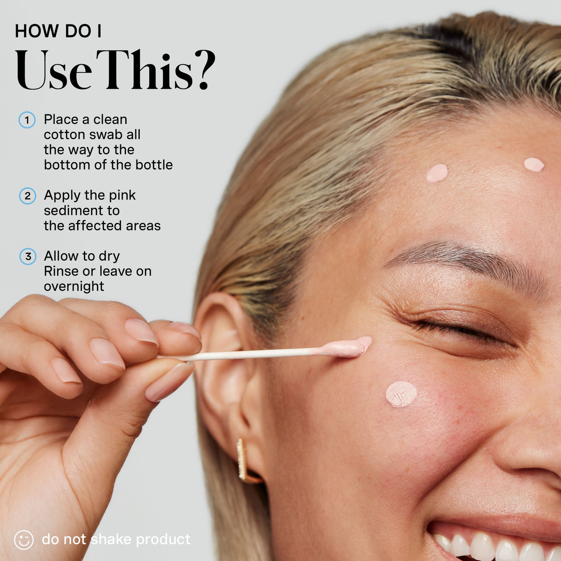 EradiKate® 10% Sulfur Acne Treatment