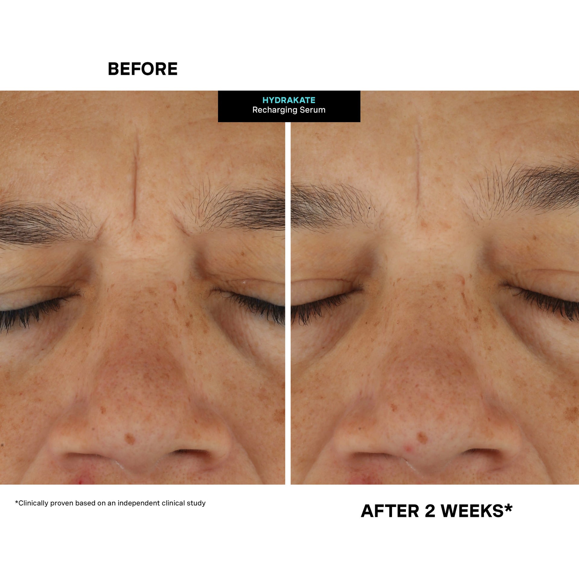 HydraKate® Recharging Serum