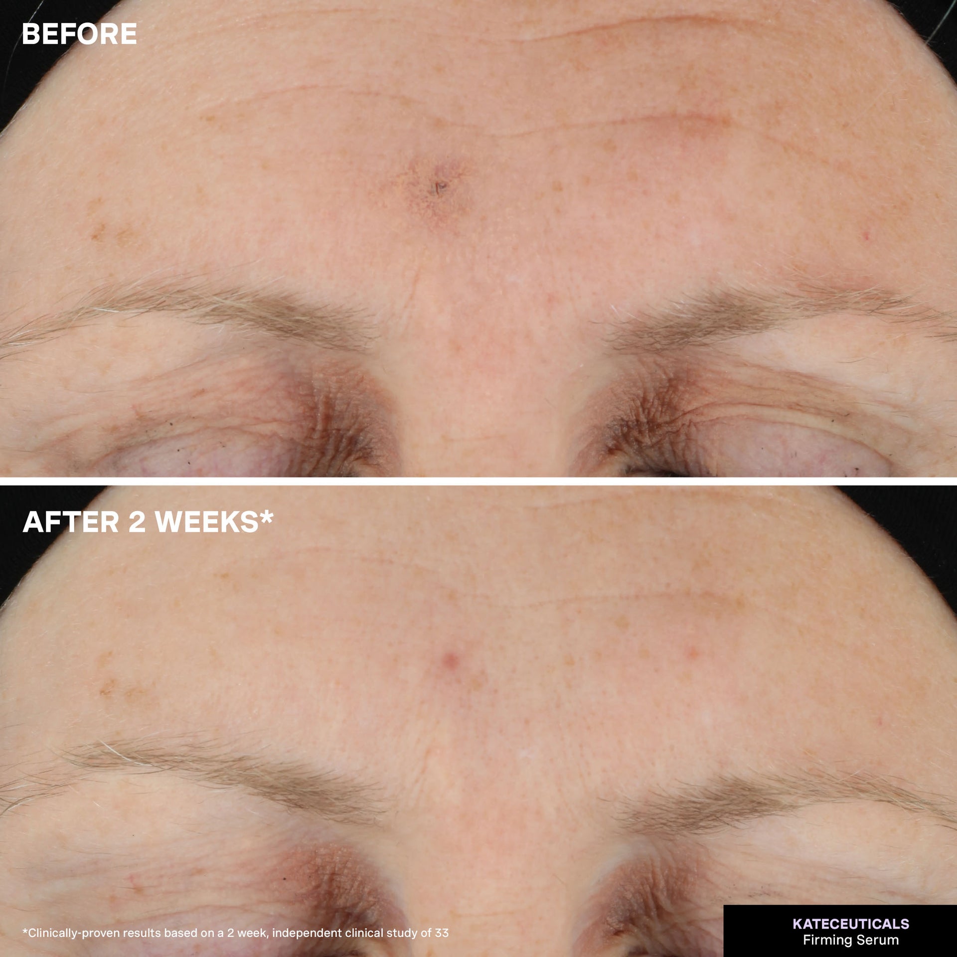 KateCeuticals® Firming Serum