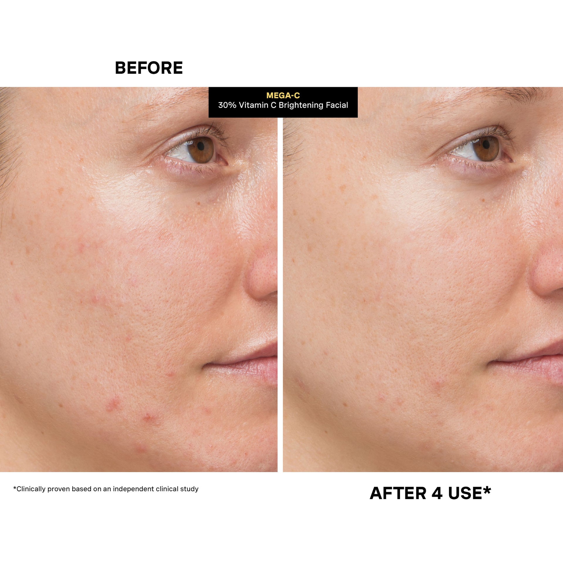 Mega-C® 30% Vitamin C Brightening Facial