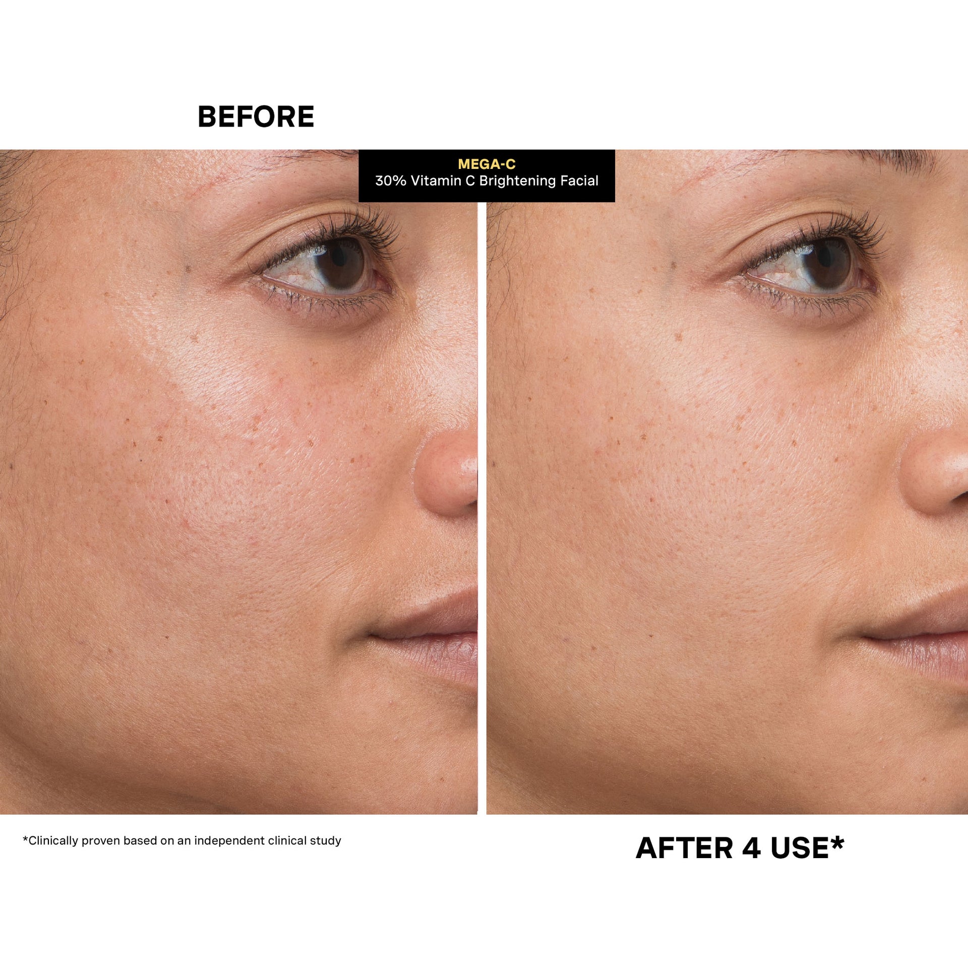 Mega-C® 30% Vitamin C Brightening Facial