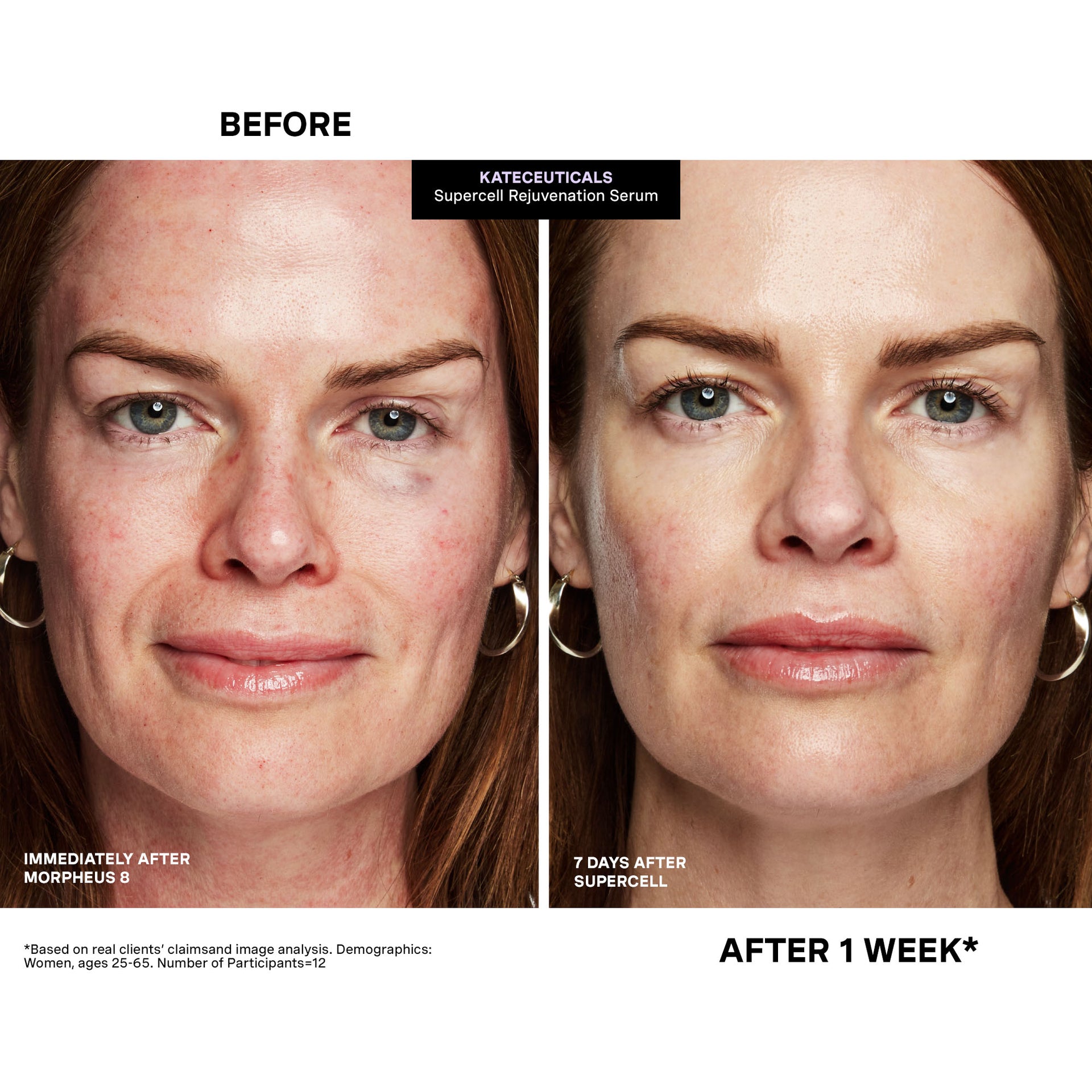 KateCeuticals® SuperCell Rejuvenation Serum