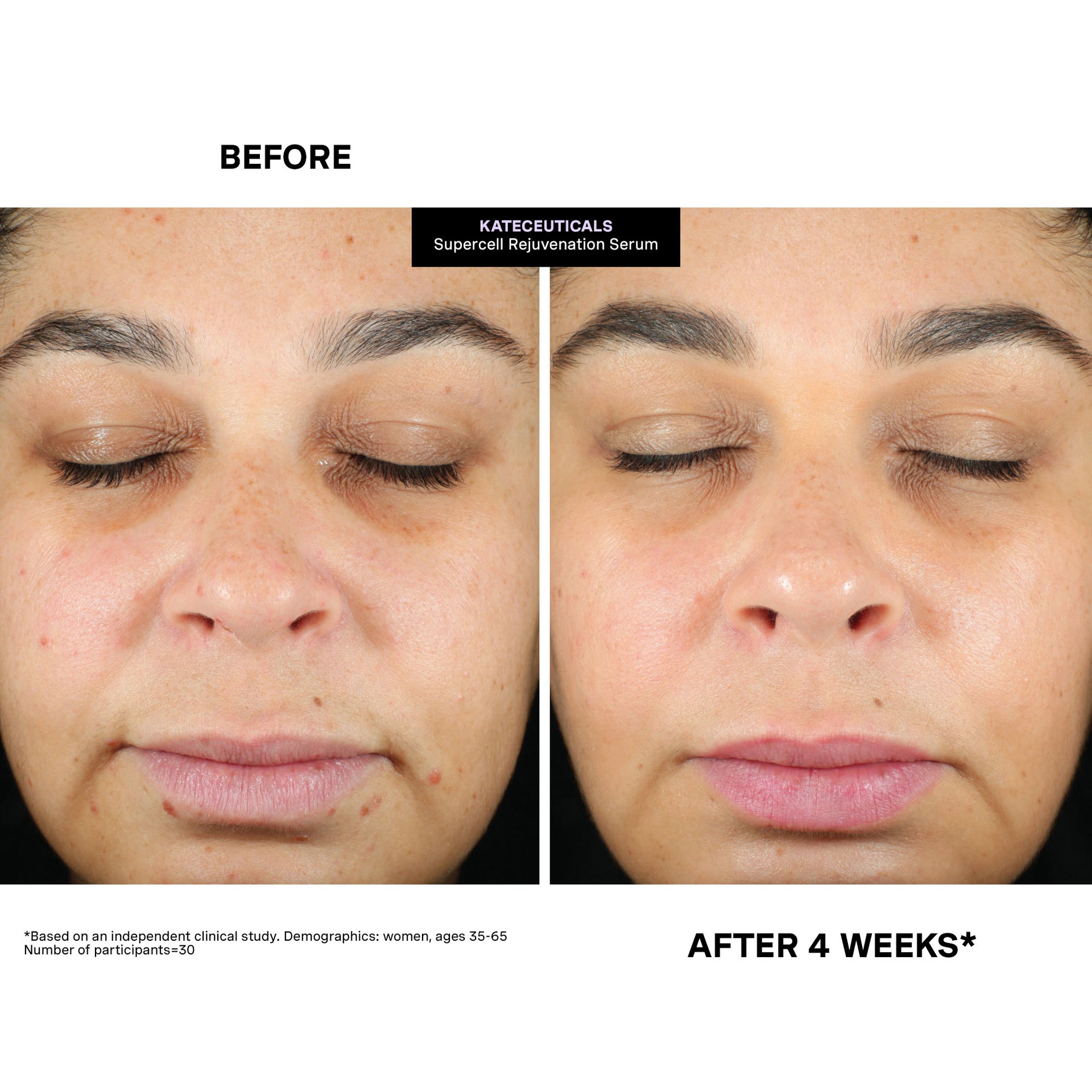 KateCeuticals® SuperCell Rejuvenation Serum