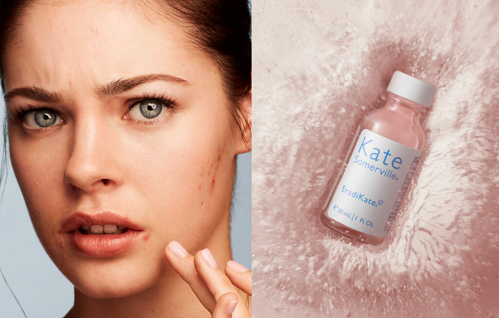 DIET DO’S & DON'TS FOR HORMONAL ACNE