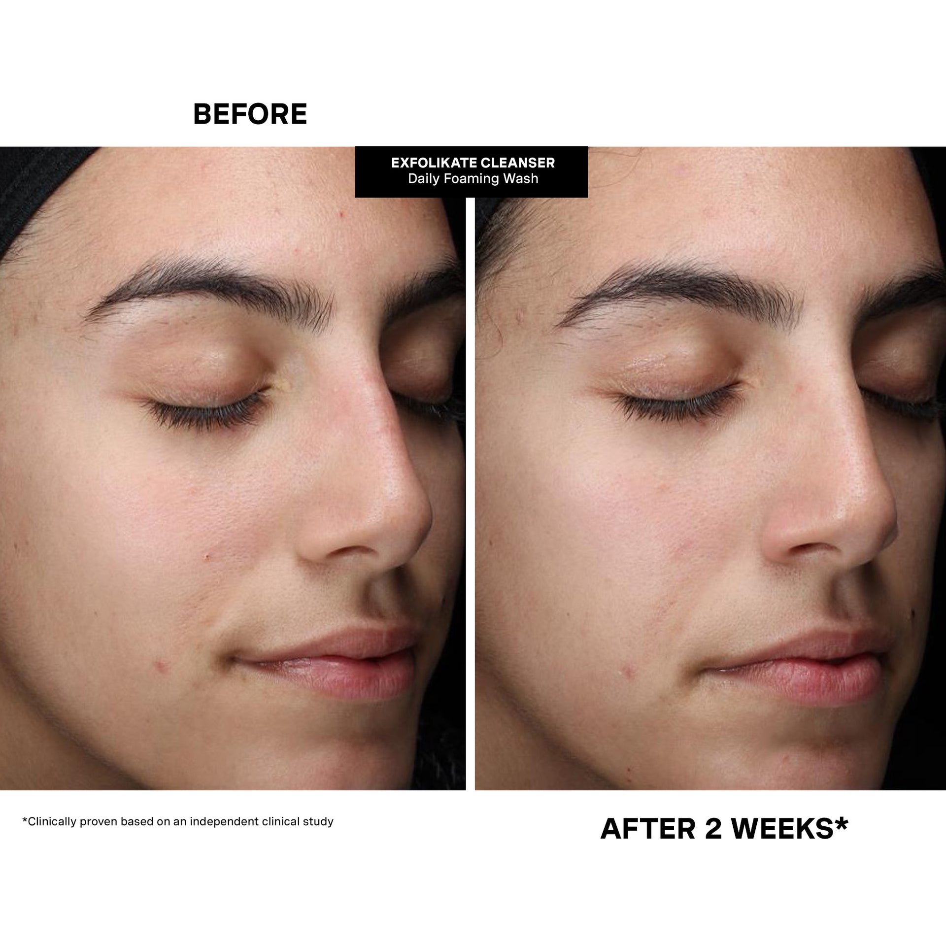 Pore-fect Skin Edit
