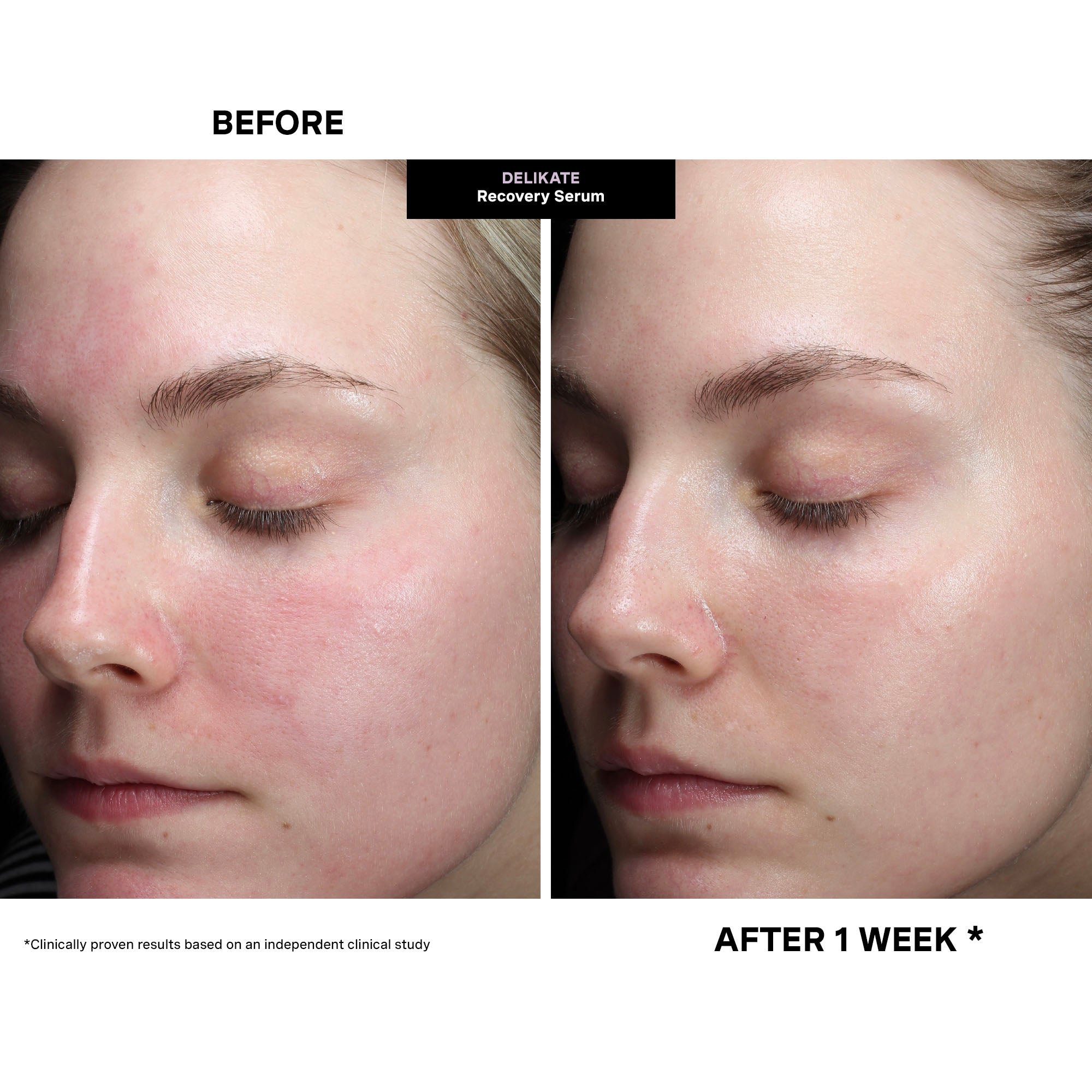 Soothing Serum For Stressed & Sensitized Skin - Kate Somerville