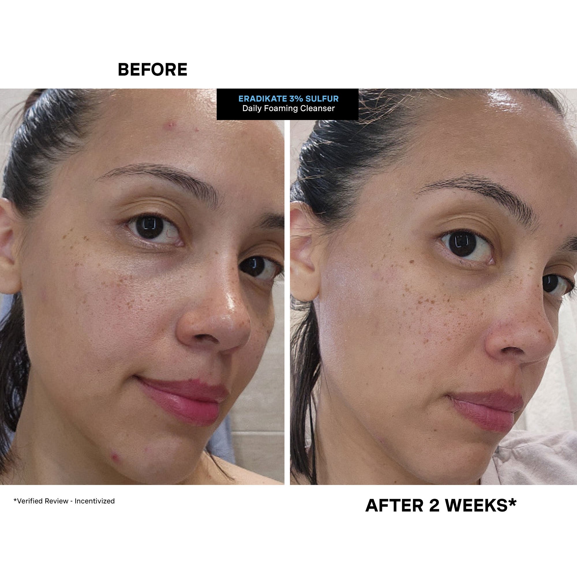 EradiKate® 3% Sulfur Daily Foaming Cleanser Duo – Kate Somerville US
