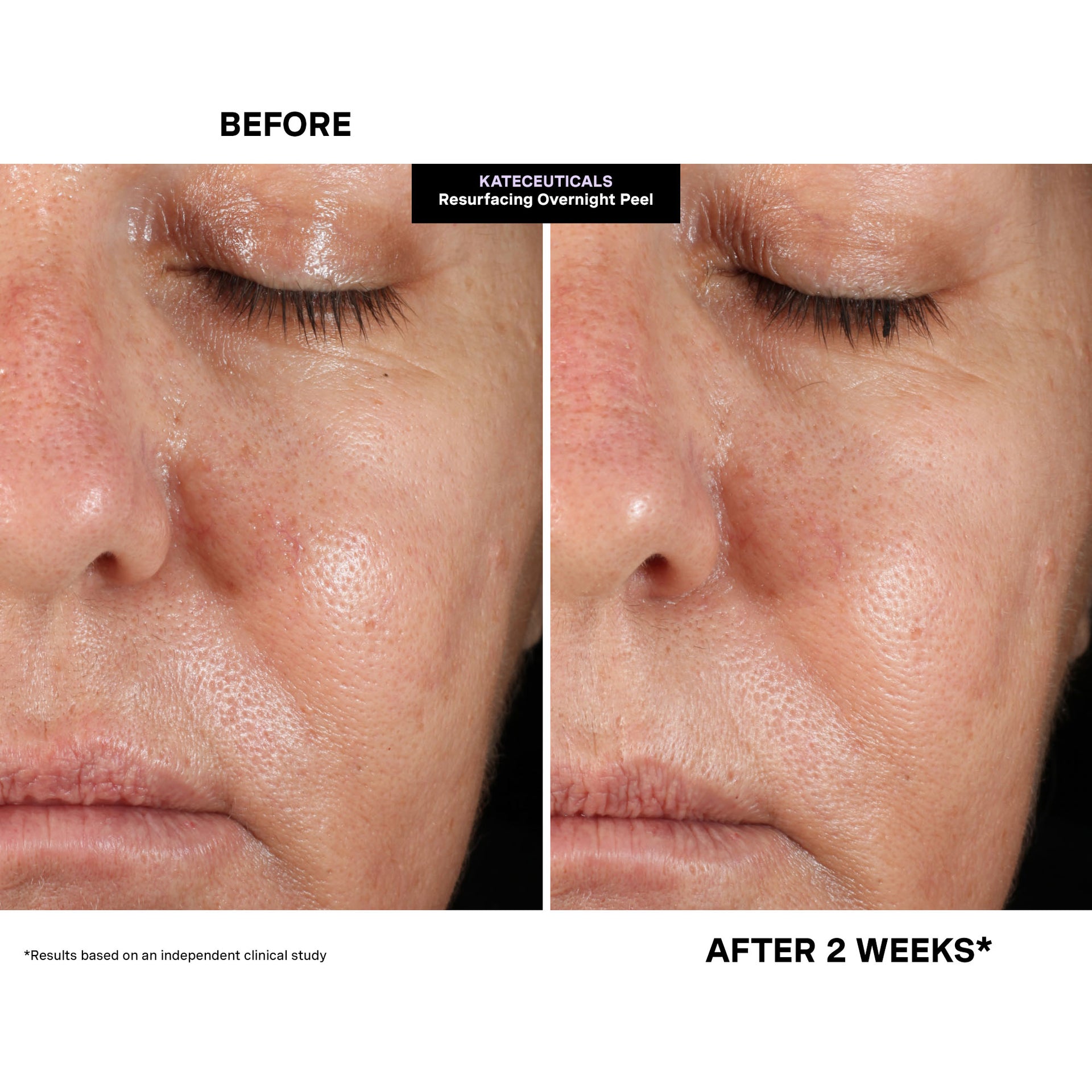 KateCeuticals™ Resurfacing Overnight Peel