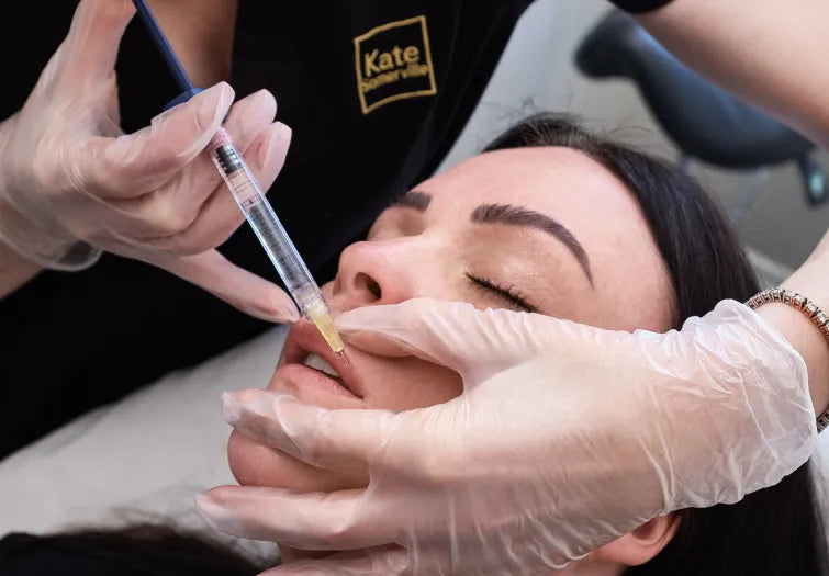 Lip Filler Los Angeles