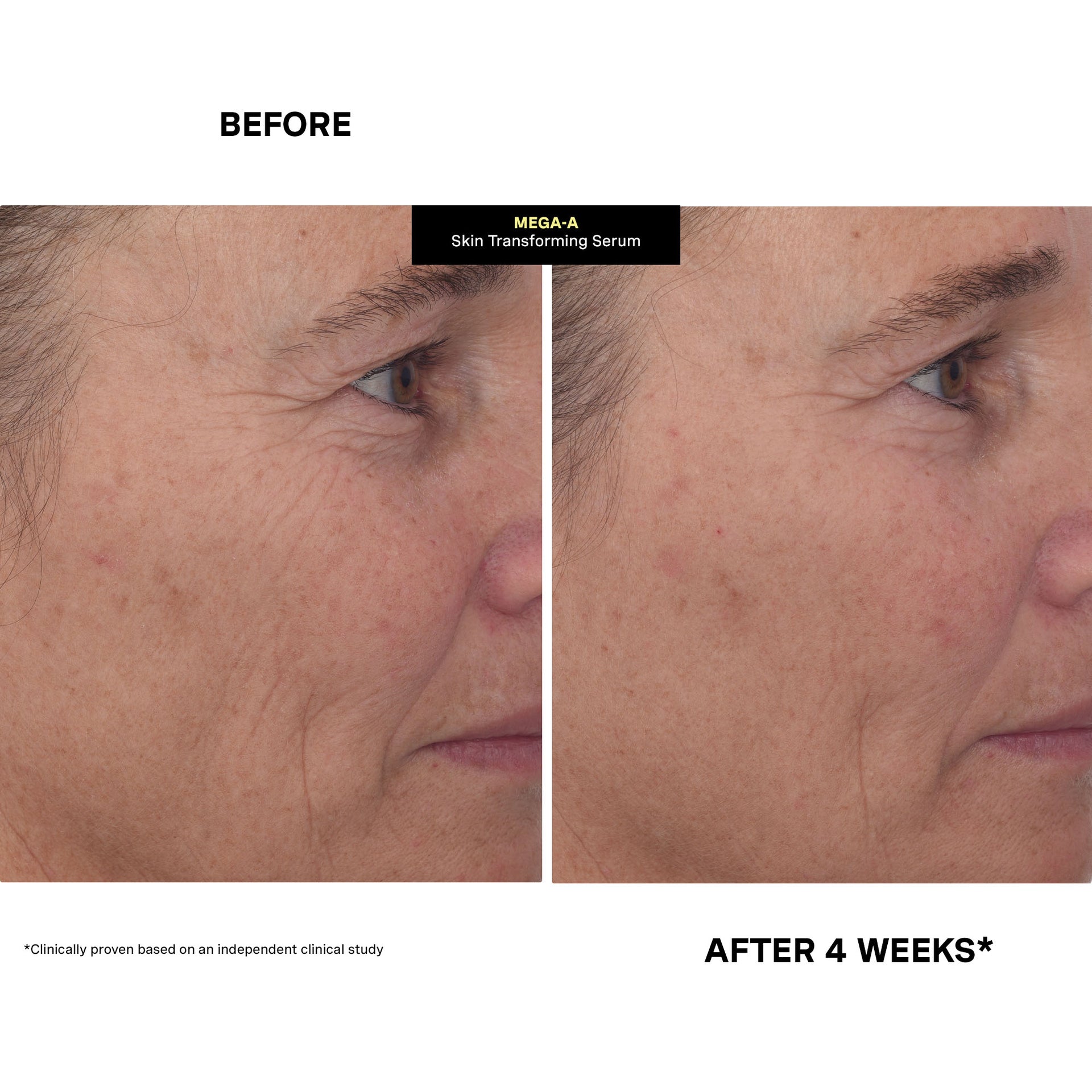 MEGA-A Skin Transforming Serum