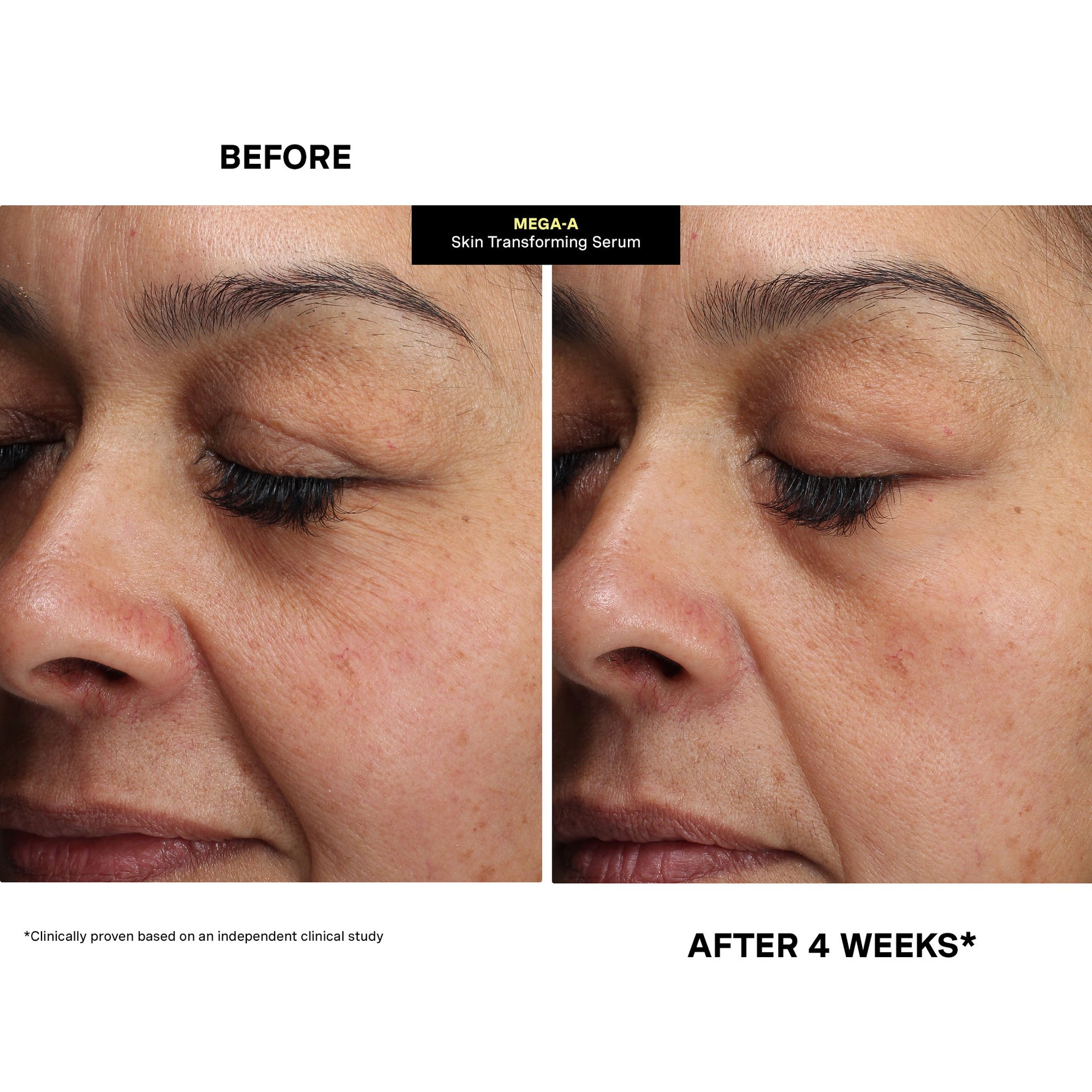 MEGA-A Skin Transforming Serum