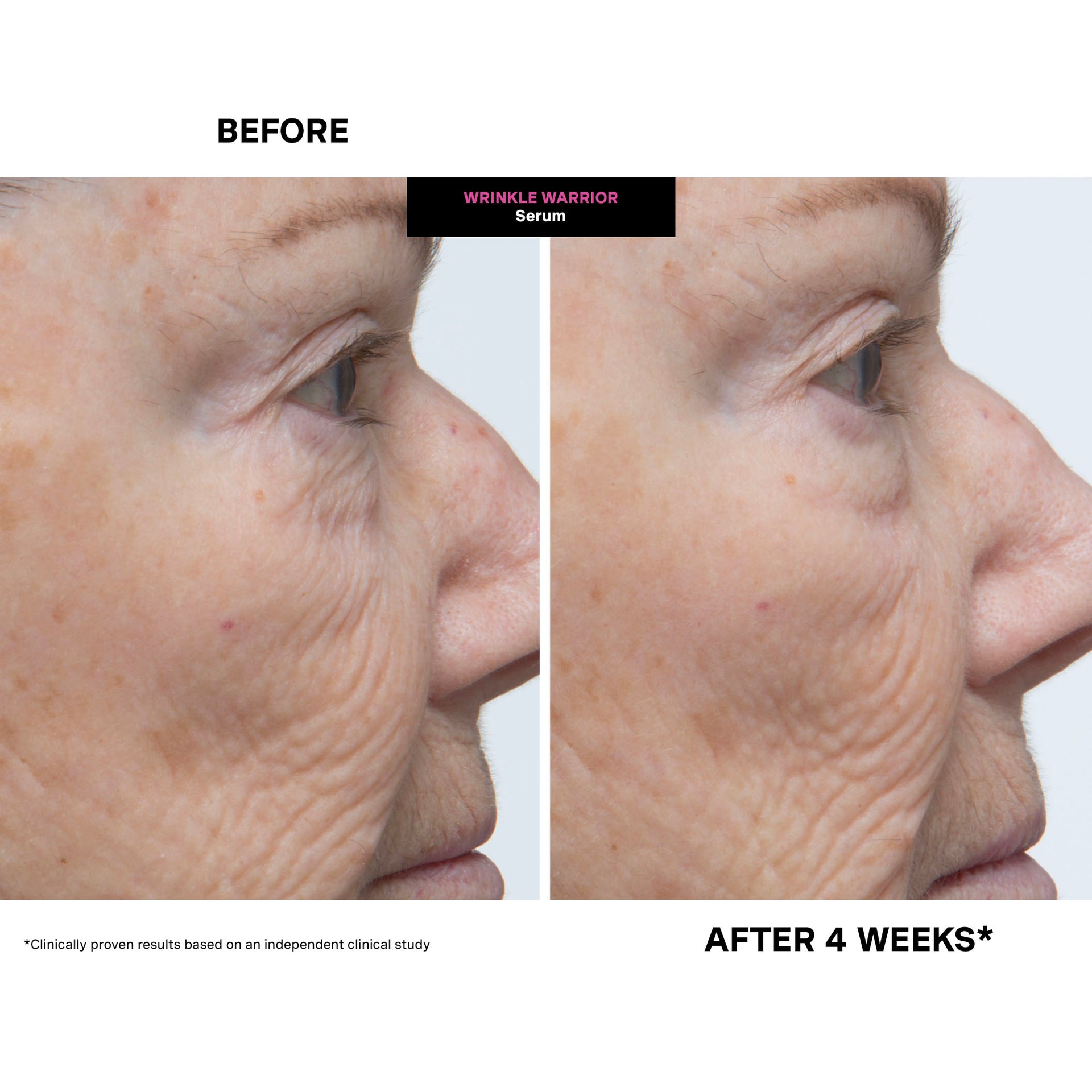 Wrinkle Warrior® 2-in-1 Plumping Moisturizer + Serum