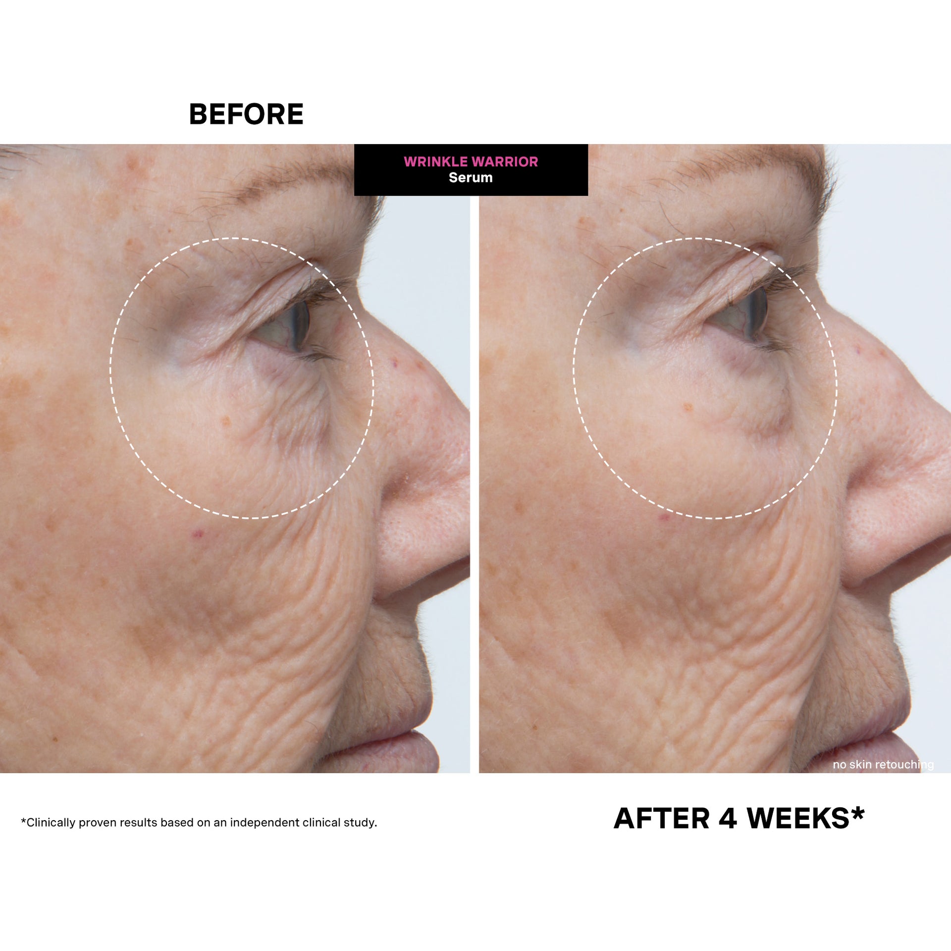 Wrinkle Warrior® 2-in-1 Plumping Serum + Moisturizer