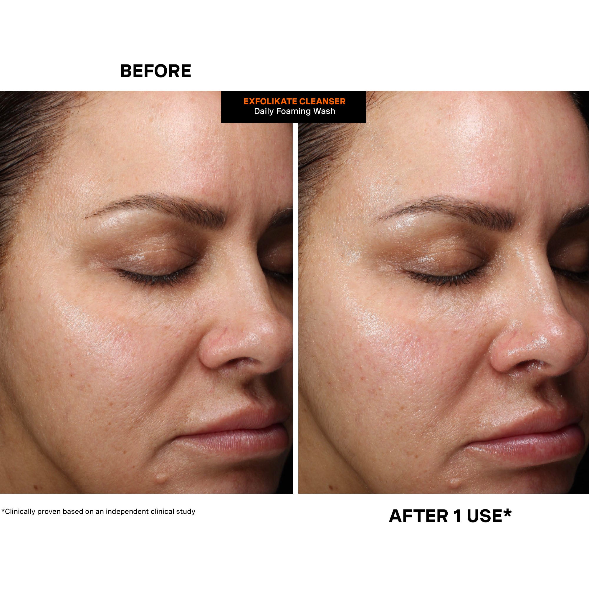 ExfoliKate® Cleanser Daily Foaming Wash Duo – Kate Somerville US