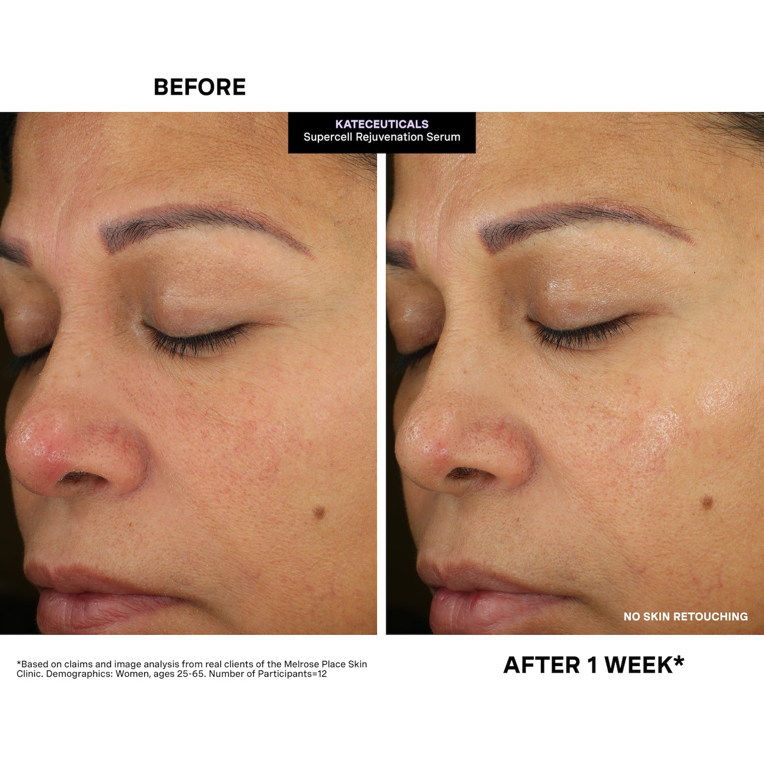 KateCeuticals® SuperCell Rejuvenation Serum