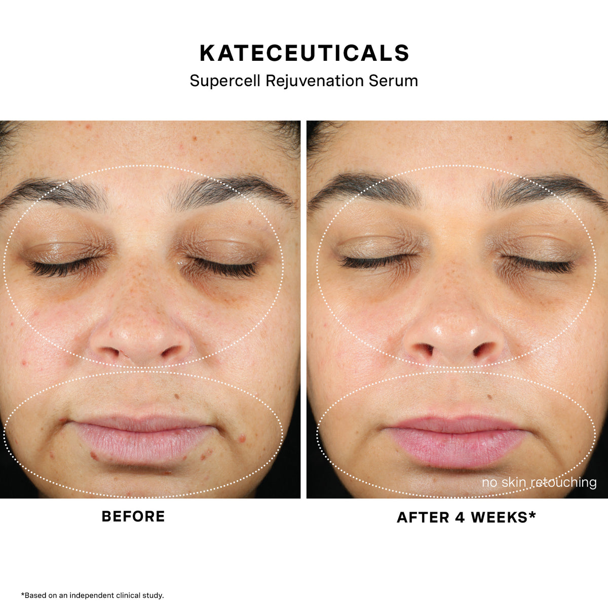 Before and after results 1