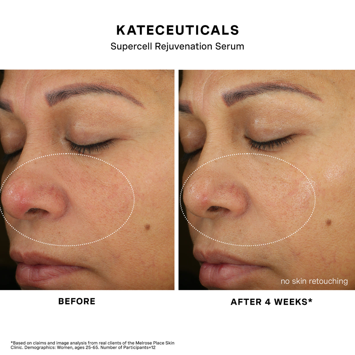 Before and after results 2