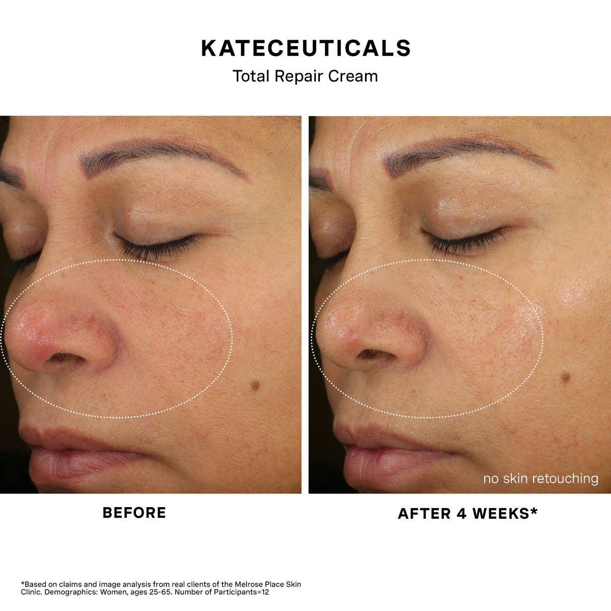 KateCeuticals Total Repair Cream before and after 4 weeks