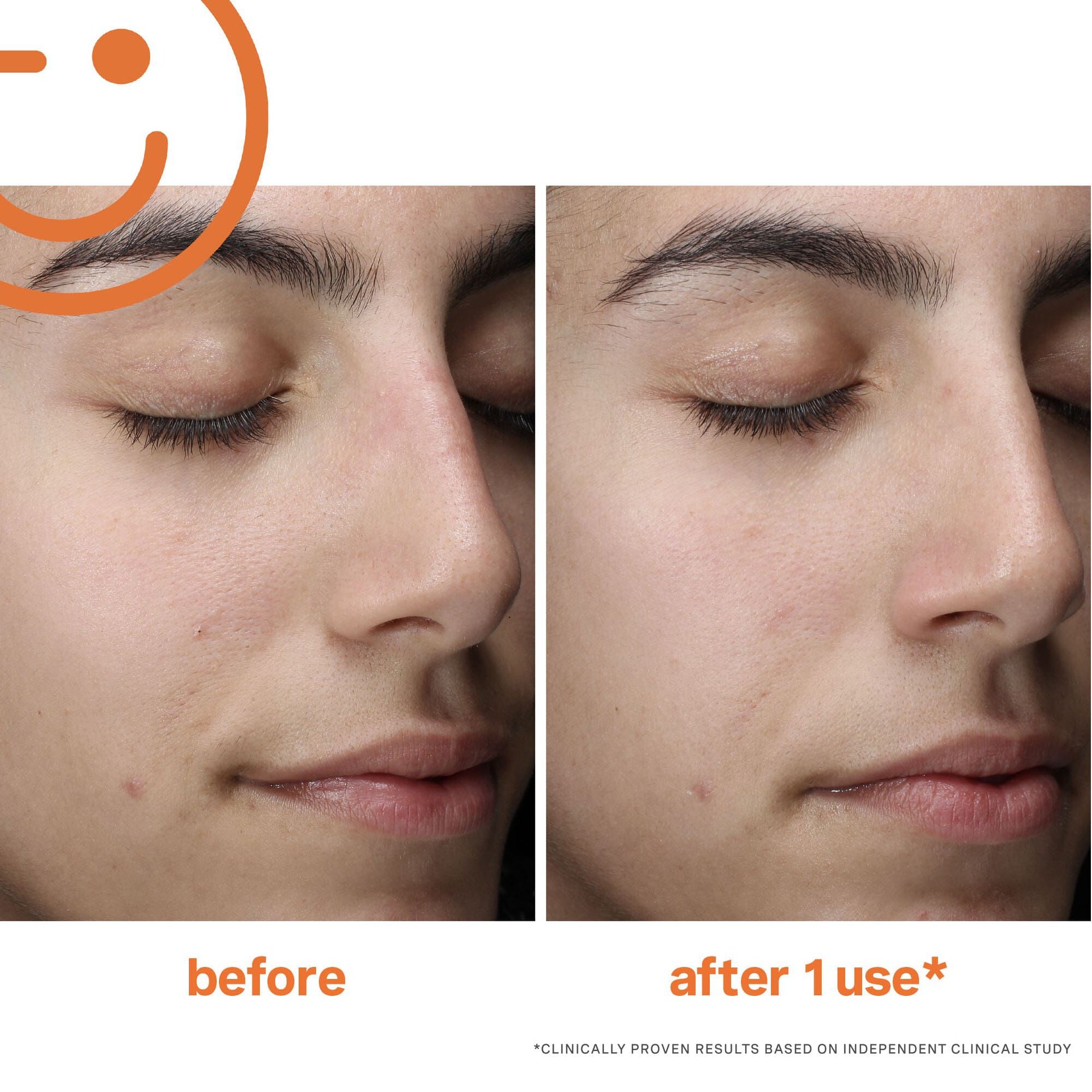 ExfoliKate® Cleanser Mini